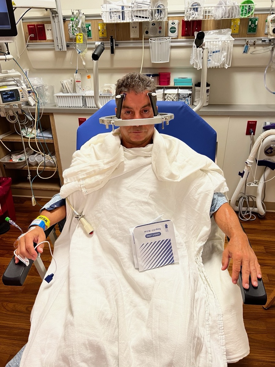 A patient with a stereotactic frame being prepared for deep brain stimulation surgery.